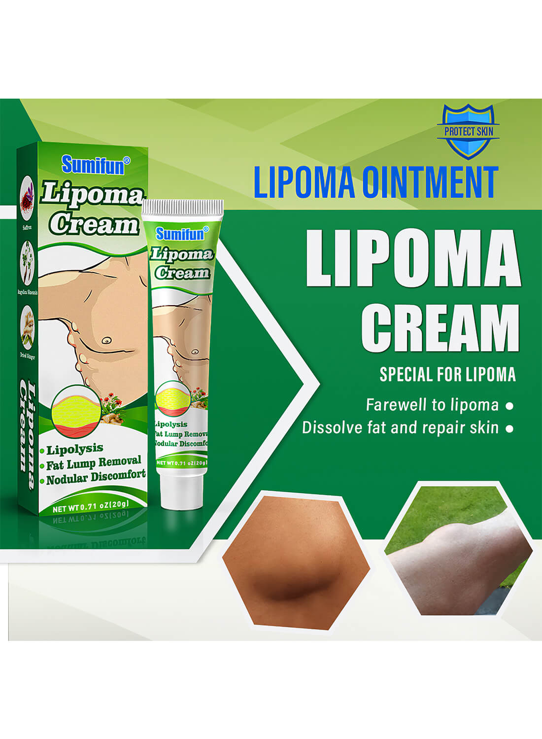 Sumifun Lipoma Removal Cream 20g