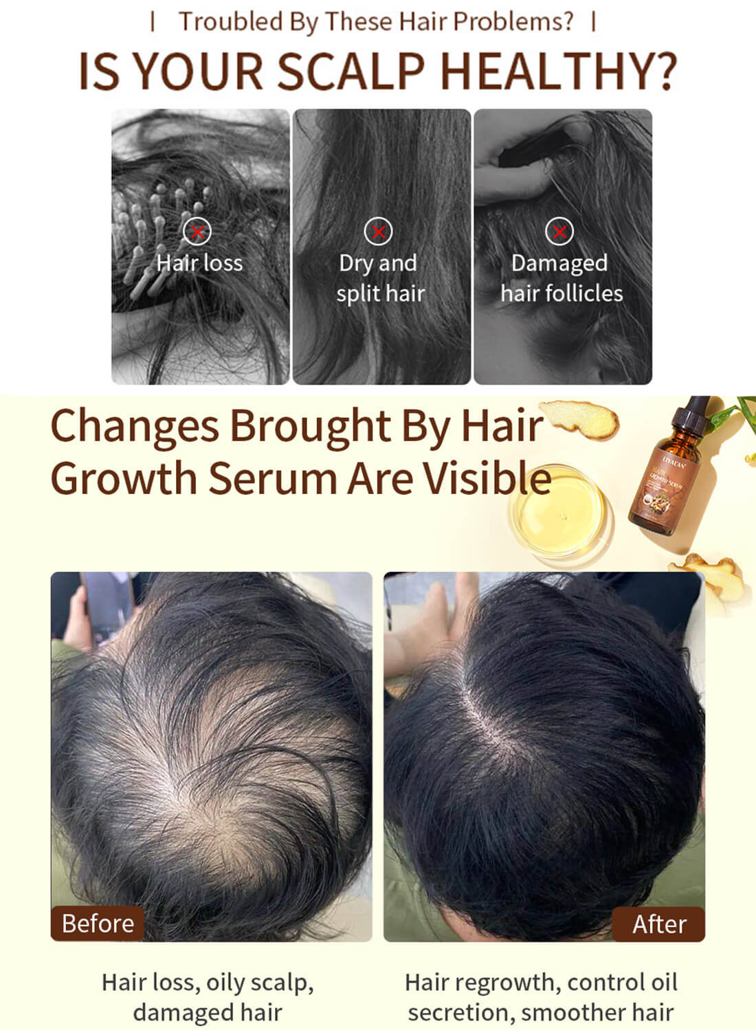 Liyalan Hair Growth Serum with Ginger Extract 30ml