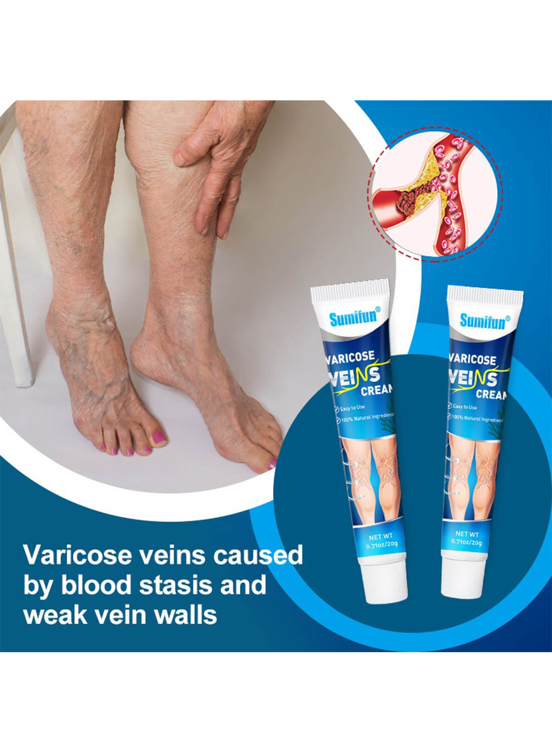 Varicose Veins Cream, Natural Varicose Veins Treatment for Legs 20g