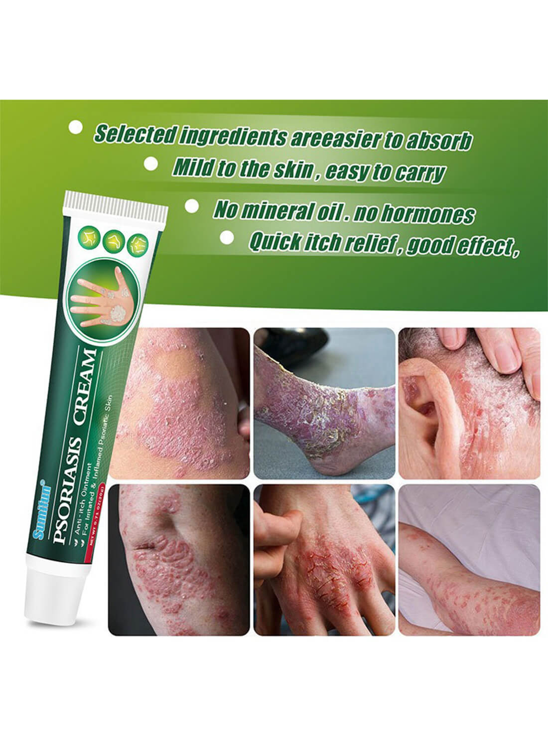 Psoriasis Cream, Anti-Itch Ointment 20g