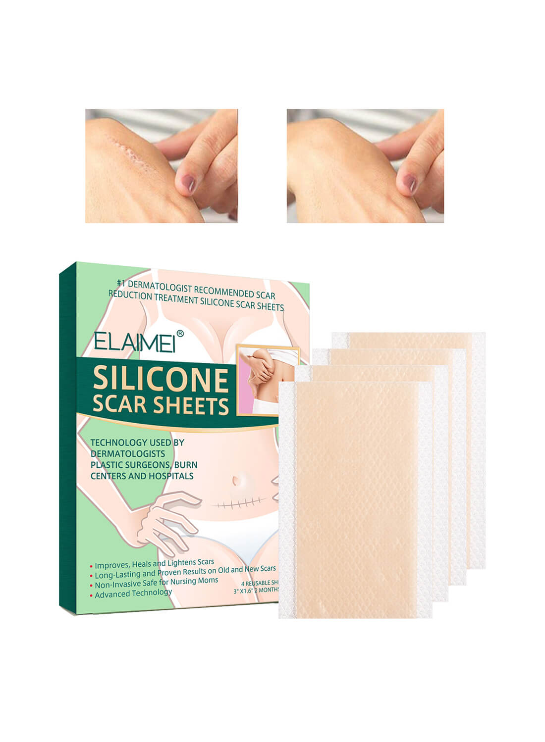 ELAIMEI Silicone Scar Sheets Skin Care 4Pcs